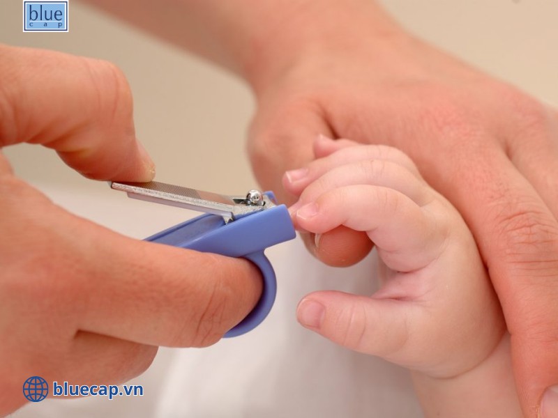 Phụ huynh nên vệ sinh móng tay tránh trẻ tự làm xước da
