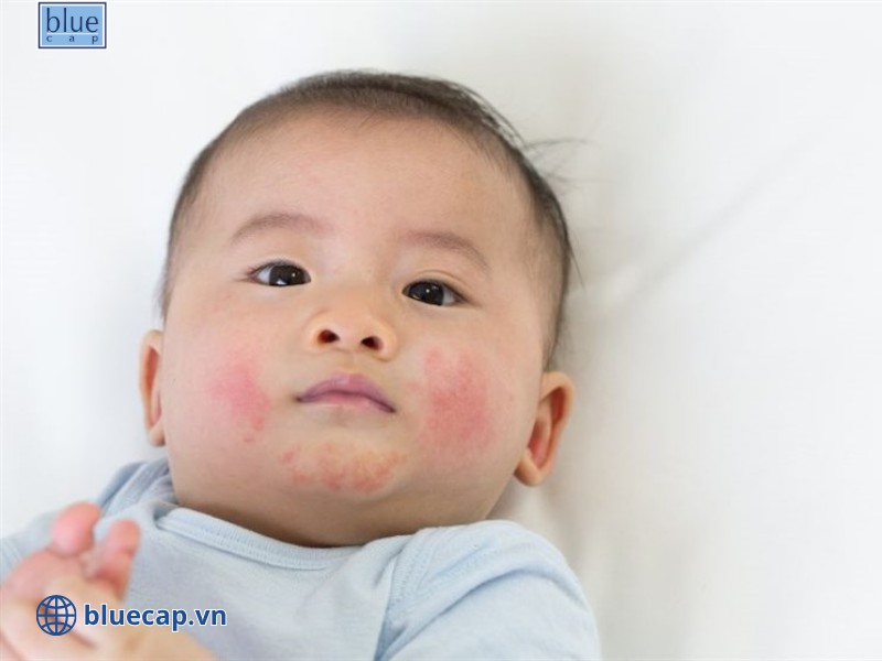 Mẹ không nên trong chờ rằng bệnh sẽ tự khỏi