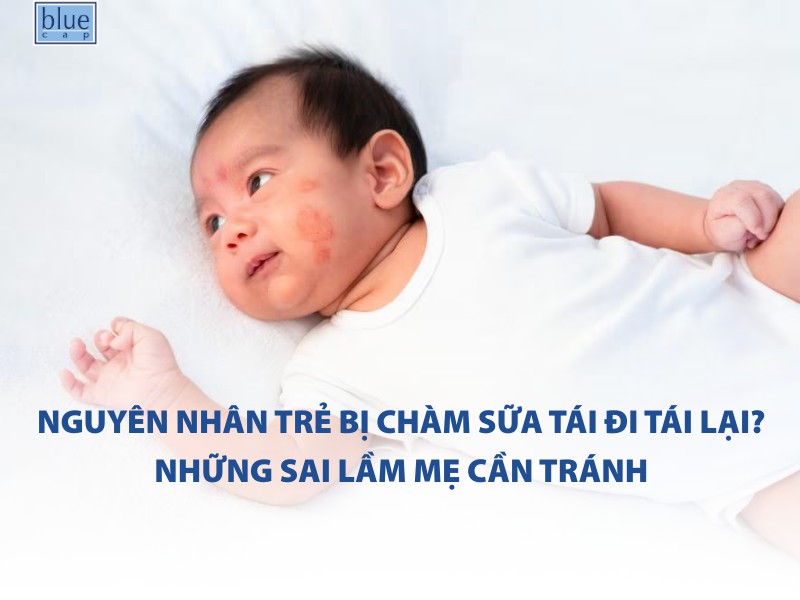 Nguyên nhân trẻ bị chàm sữa tái đi tái lại? Những sai lầm mẹ cần tránh