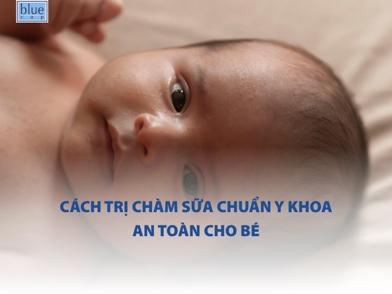 Cách trị chàm sữa chuẩn y khoa an toàn cho bé
