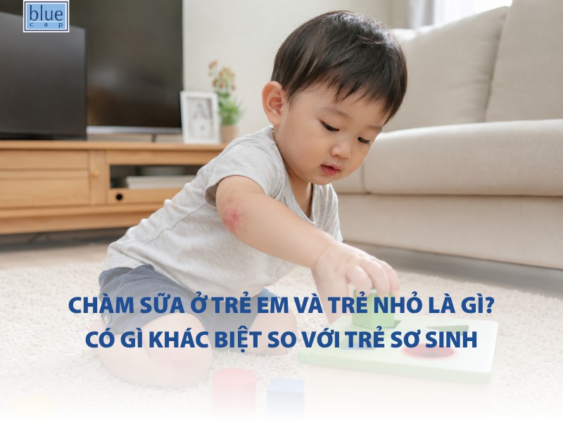 Chàm sữa trẻ em và trẻ nhỏ là gì? Có gì khác biệt so với trẻ sơ sinh