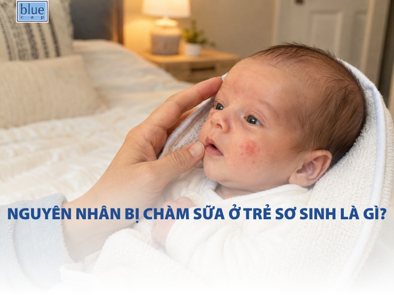 Nguyên nhân bị chàm sữa ở trẻ sơ sinh là gì?