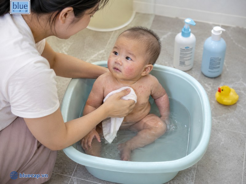 Không nên sử dụng sản phẩm hay sữa tắm dùng nhiều bọt trong quá trình chăm sóc chàm sữa ở trẻ sơ sinh
