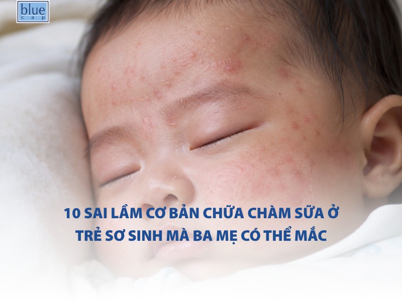 10 sai lầm cơ bản chữa chàm sữa ở trẻ sơ sinh mà ba mẹ có thể mắc