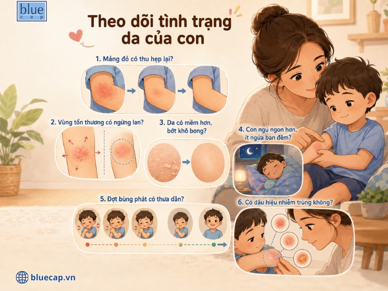 Kiểm tra các dấu hiệu chàm sữa ở con để xem phương pháp đang sử dụng có hiệu quả