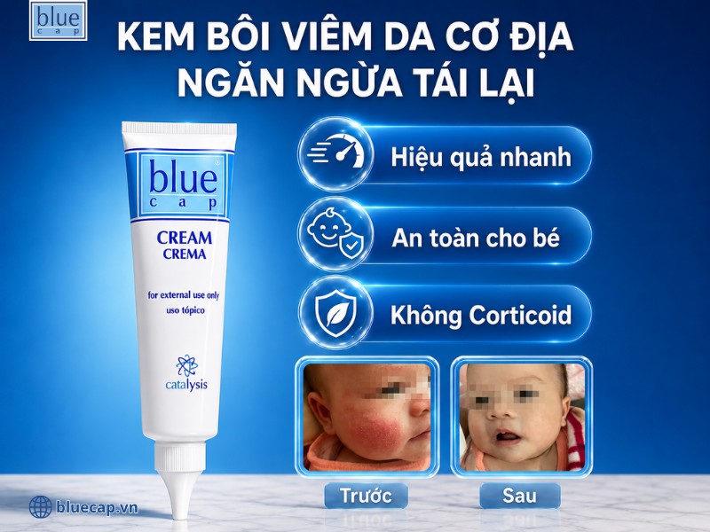 Kem bôi chàm sữa trẻ em Blue Cap Cream chính hãng