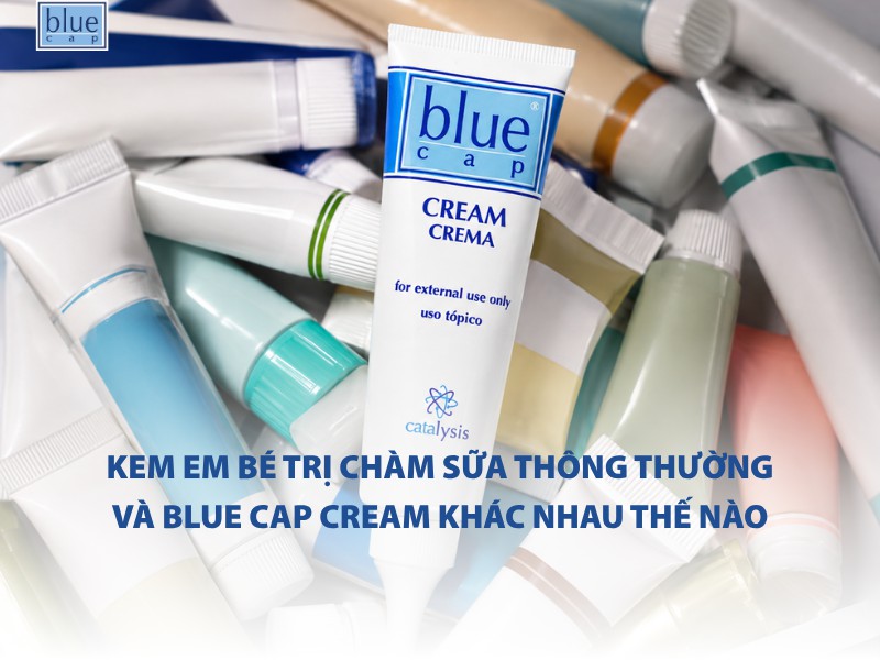 Kem em bé trị chàm sữa thông thường và Blue Cap Cream khác nhau thế nào
