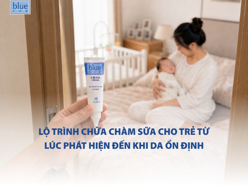 Lộ trình chữa chàm sữa cho trẻ từ lúc phát hiện đến khi da ổn định